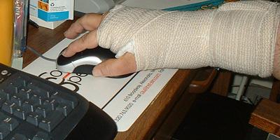 Carpal tunnel surgery ties up your hands